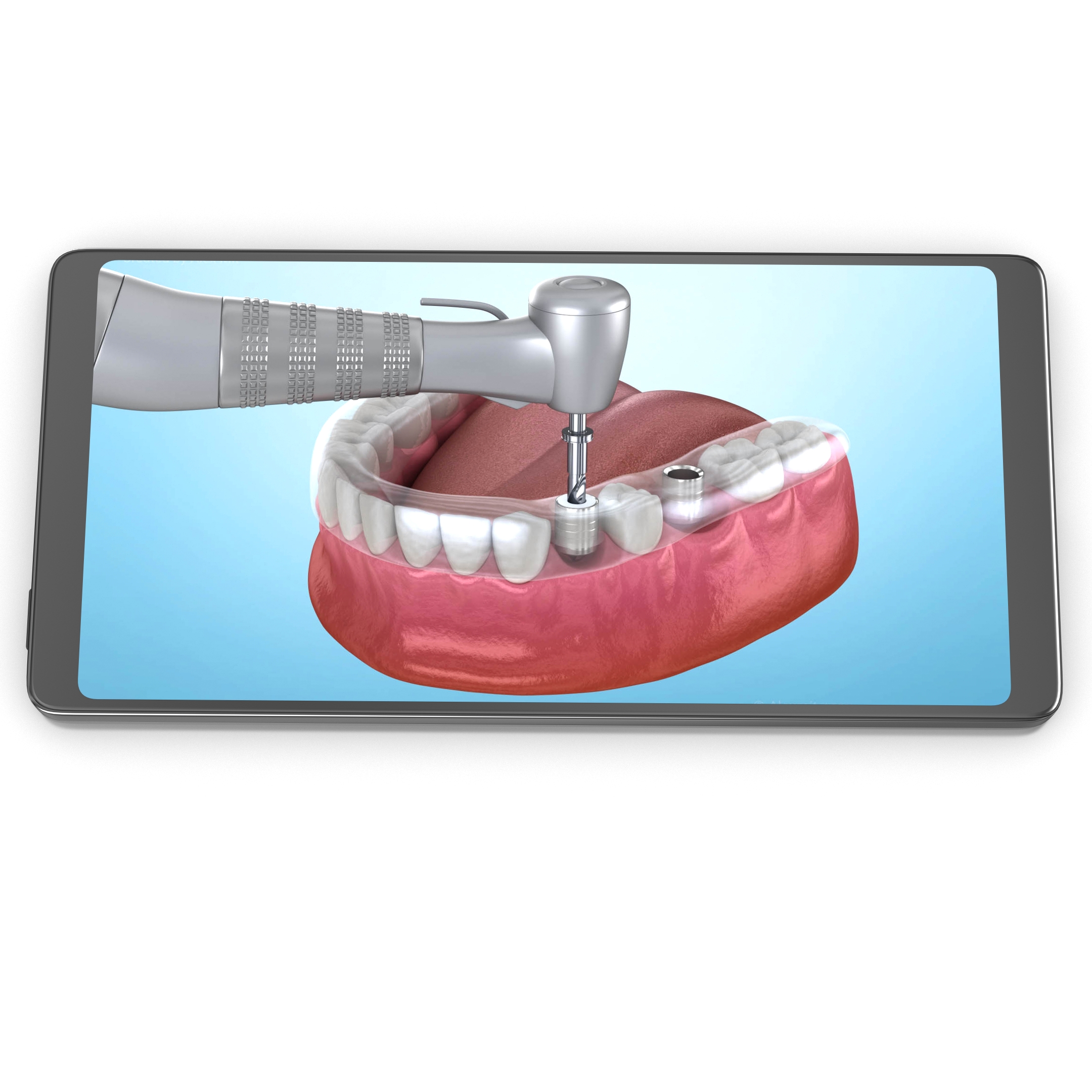 dental app on IOS and Android